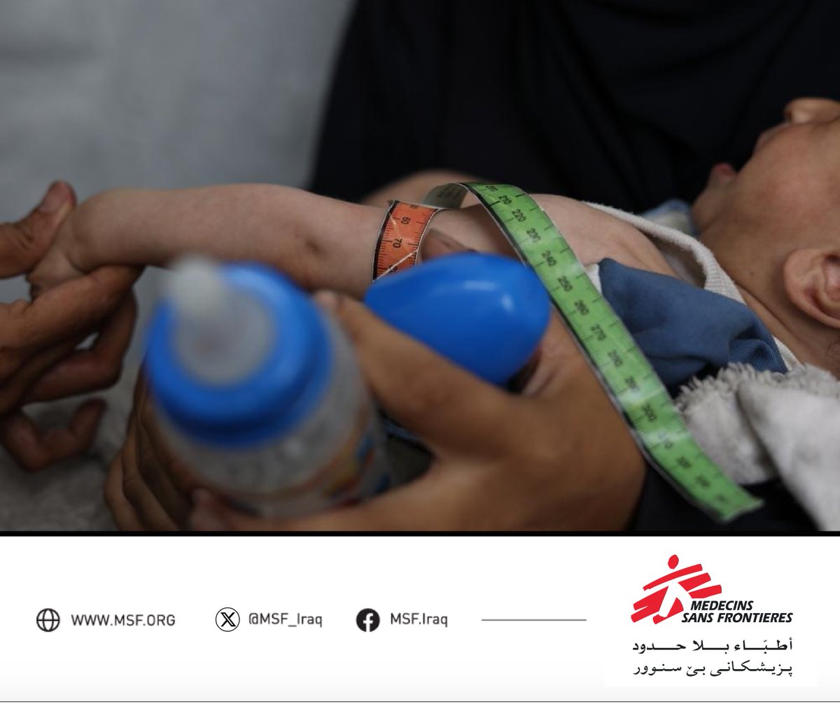 MSF_Iraq's tweet image. 6-month-old Ibrahim arrived at Nablus Hospital severely malnourished, weighing just 4.06 kg. After 5 days of care, he left stronger at 4.45 kg. Most malnourished babies we see were not breastfed. Breastfeeding saves lives. #MSF #Malnutrition #Iraq
