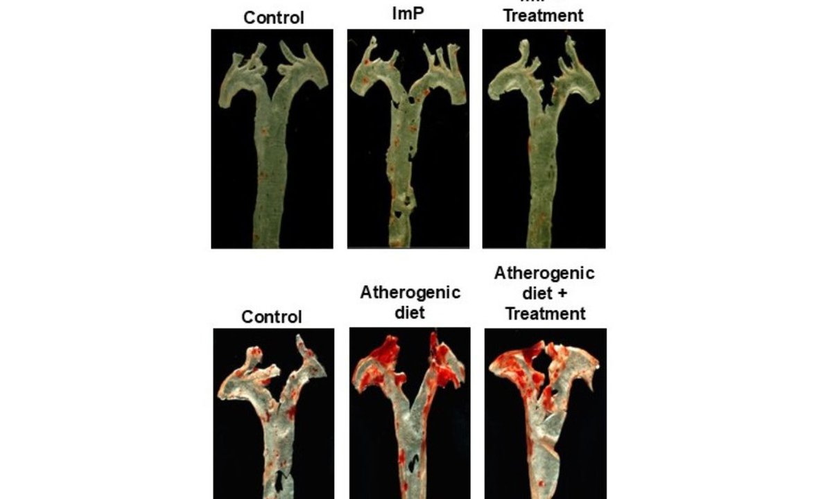 ERC_Research's tweet image. 🧬 A new study by @dsancho77 @CNIC_CARDIO links the gut-derived metabolite imidazole propionate (ImP) to #atherosclerosis. The research explores ImP as a potential marker & contributor to early disease development.
👉 europa.eu/!wBktrm
#CardiovascularResearch #Cardiology