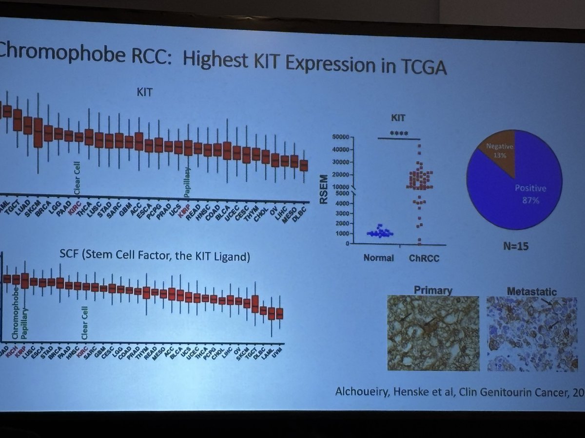 MosheOrnsteinMD's tweet image. Dr. Henske #KCRS25 providing important updates on chromophobe RCC. Interesting data regarding KIT as a potential target with early phase ongoing trials. @kidneycan