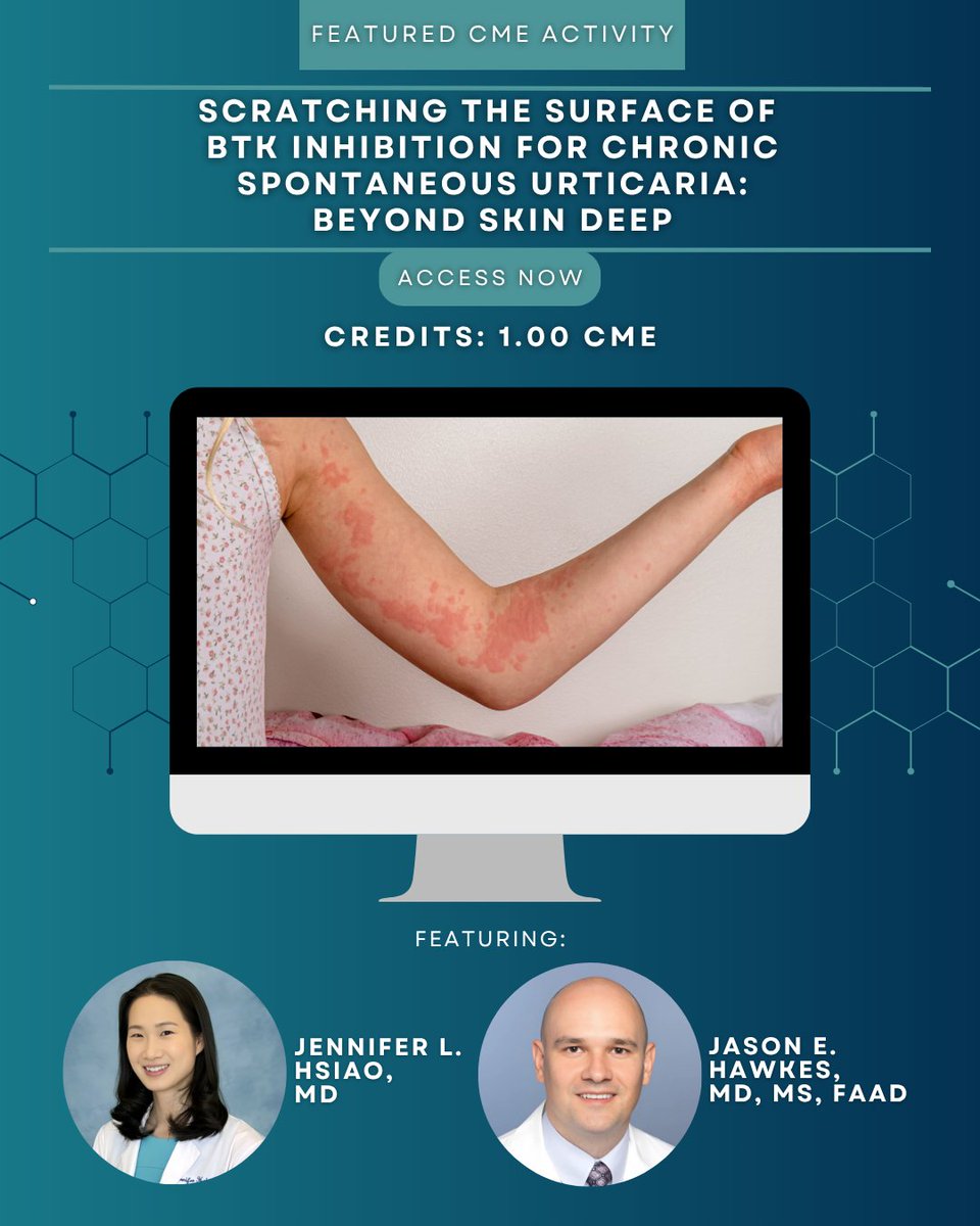 Recent data indicate that BTK inhibition can provide significant symptom relief for chronic spontaneous urticaria.

To explore the role of BTK inhibition in the treatment of this disease, enroll in our virtual educational activity.

🔗 go.livderm.org/46fSQR8

#ChronicUrticaria