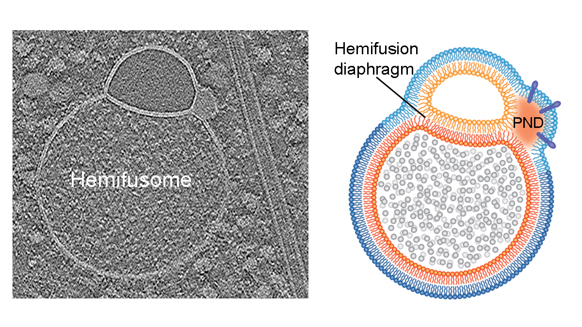 NEIDirector's tweet image. Meet the ‘hemifusome’:
A newly discovered vesicular organelle complex with a unique membrane topology. Could it play a role in protein and lipid sorting, recycling, and intraluminal vesicle formation?
@IRPatNIH @BecharaKachar
@NatureComms paper: brnw.ch/21wUdrP