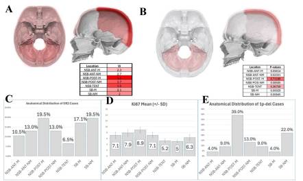 JNeurooncol's tweet image. Koçyiğit et al @saidkocyigit @acibademuni showed that posterior parasagittal meningiomas exhibit aggressive features—such as higher grade and brain invasion—independent of size, highlighting critical role of tumor location in risk stratification.#JNO
link.springer.com/article/10.100…
