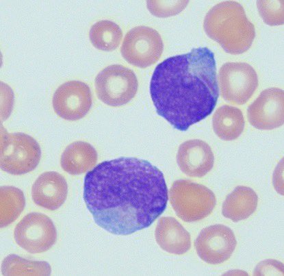 Nourhan Ibrahim (@nourhan_path22) on Twitter photo Auer rod is Auer RODING! Auer rod is Auer RODING!