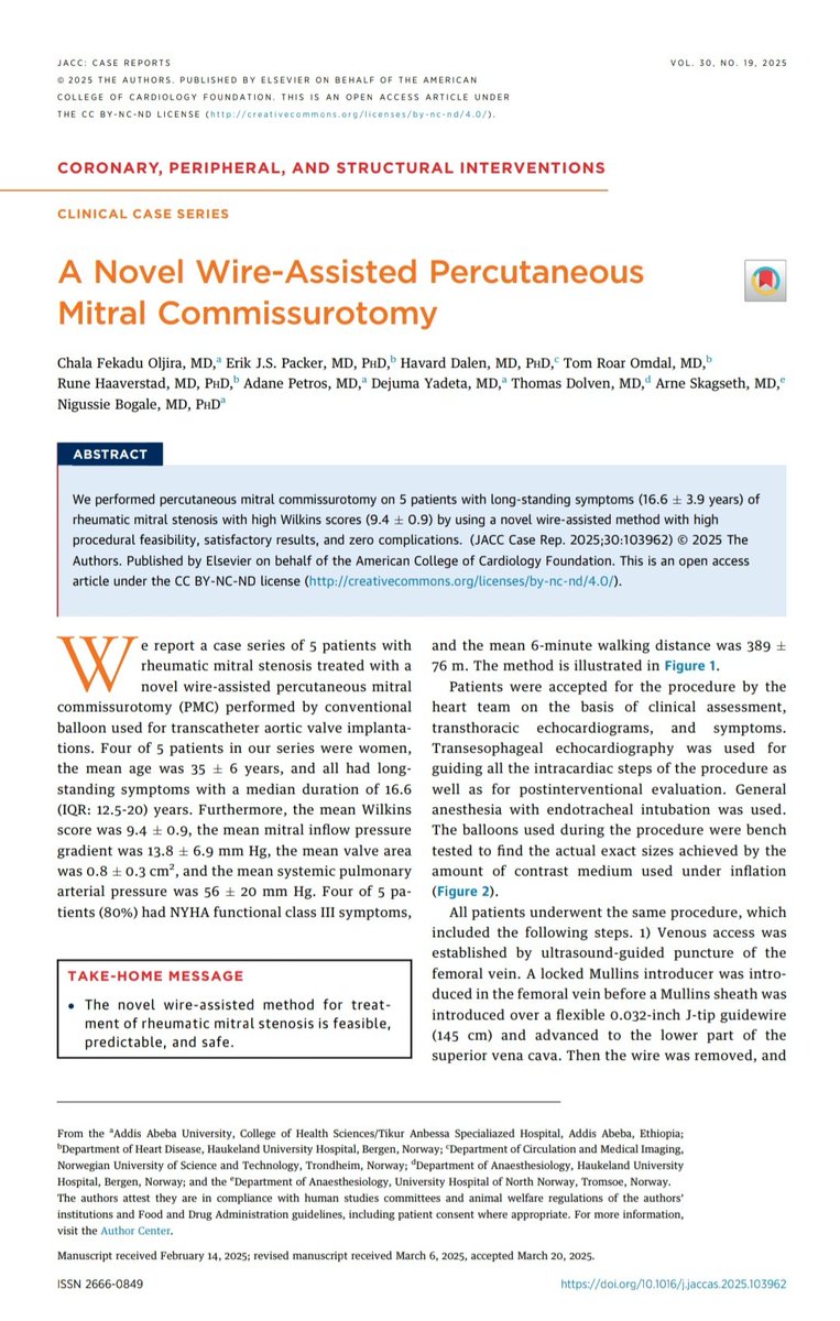 Chala Fekadu (@chalafekadu12) on Twitter photo I am extremely excited to share our publication on Jacc case reports in which we highlighted our experience of the novel wire assisted mitral commissurotomy in Patients with Rheumatic mitral stenosis.
<a href="/mmamas1973/">Mamas A. Mamas</a> <a href="/SHDcathman/">clifford jay kavinsky</a> <a href="/TTelila/">Tesfaye A. Telila MD, FACC,FSCAI.</a> <a href="/drmerid/">Obsinet Merid, MD</a> I am extremely excited to share our publication on Jacc case reports in which we highlighted our experience of the novel wire assisted mitral commissurotomy in Patients with Rheumatic mitral stenosis.
<a href="/mmamas1973/">Mamas A. Mamas</a> <a href="/SHDcathman/">clifford jay kavinsky</a> <a href="/TTelila/">Tesfaye A. Telila MD, FACC,FSCAI.</a> <a href="/drmerid/">Obsinet Merid, MD</a>