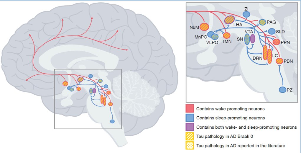 grinberg_t's tweet image. 🧠 Did you know? The neuromodulatory subcortical system degenerates early in #Alzheimer, before memory loss is apparent.
Understanding NSS could be key to #earlydetection & intervention.
👉 Curious? Join the @NSS_PIA to explore this frontier: bit.ly/40kftjC @ISTAART