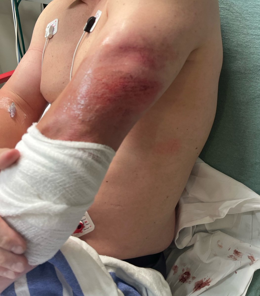 ICEgov's tweet photo. Attacks on our officers will NOT be tolerated.

While ICE @ERODallas officers were detaining Honduran illegal alien Jose Melgar-Rivas, Melgar accelerated his van and dragged an officer nearly a block down the road in an attempt to escape.

This resulted in multiple injuries to the officer's body and ended with Jose Melgar-Rivas in cuffs. 🧵