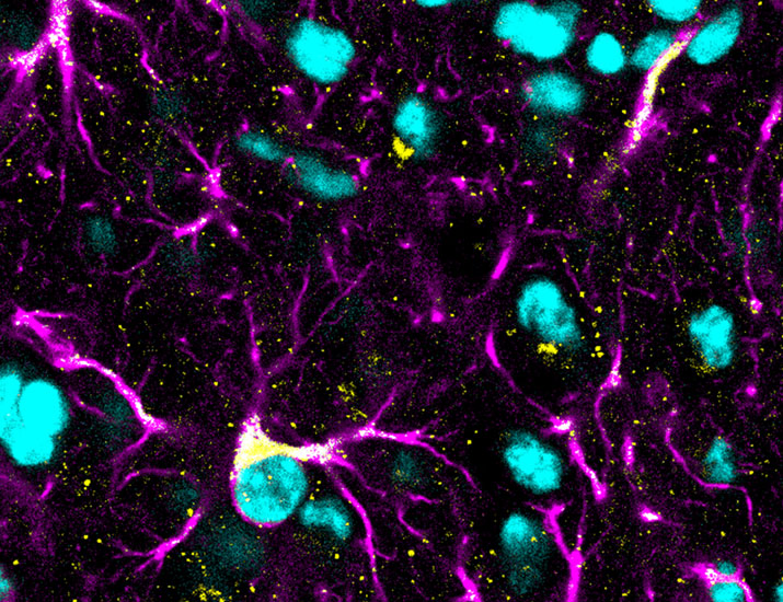 scisignal's tweet image. Although #RIPK3 is mostly known to play an inflammatory role in neurons, new results in mice show that it can also dampen inflammation in astrocytes during #flavivirus infections by increasing the abundance of Serpin3A. @briandanielsli @RutgersU scim.ag/40p7Ecq