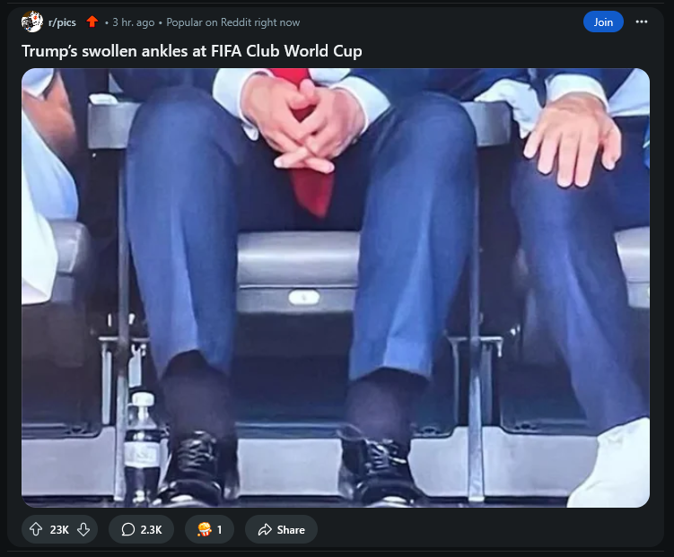 I'm so tired of the nonstop barrage of stupidity. This is the top of like 20% of subreddits on the homepage right now. Shockingly, an overweight old man has overweight old man problems. Meanwhile, Biden tripped over everything (real or not) he ever saw and nobody said shit.
