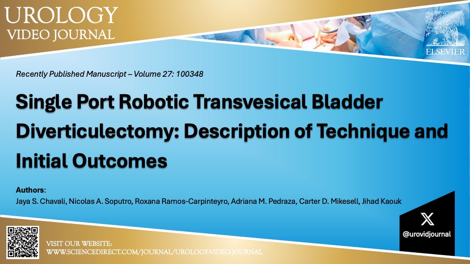 urovidjournal's tweet image. #SP Robotic Transvesical Bladder Diverticulectomy | @JayChavaliMD @NicolasSoputro @uroxlogy @PedrazaAdrianaM @CMikesellMD @drjkaouk @CleClinicUro | sciencedirect.com/science/articl…