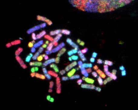 KirkMcManusLab's tweet photo. Honored to share that our team has been awarded a 5-year CIHR project grant to support our ovarian cancer research. Thank you to @CIHR_IRSC for supporting this work and to @CancerCareMBF for seed funding that enabled our preliminary efforts. https://t.co/KXfeLrajTA