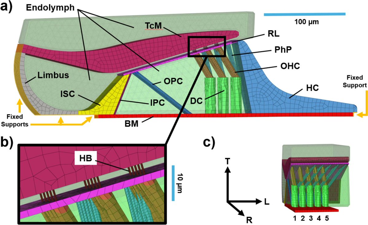 ABMEjournal's tweet image. The silent aftermath of battlefield blasts is often lifelong hearing loss – and we still don't fully understand how it happens.
To better predict and eventually prevent this damage, researchers developed a 3D finite element model of the organ of Corti, the delicate sensory…