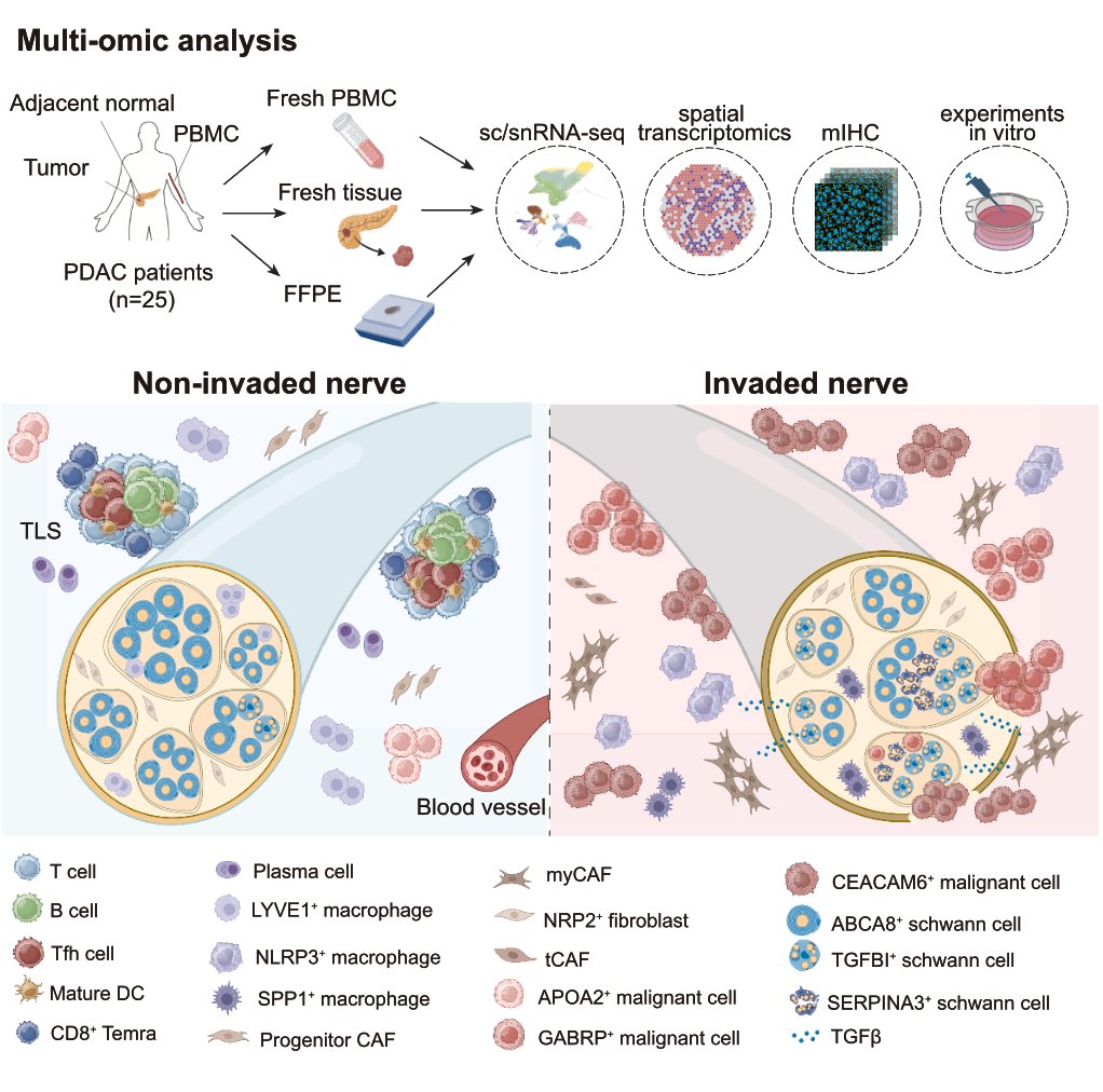 Pancreatic cancer cells can hijack neurons to facility their growth and spread. Here's the single-cell map (spatial omics) of the process
cell.com/cancer-cell/fu…