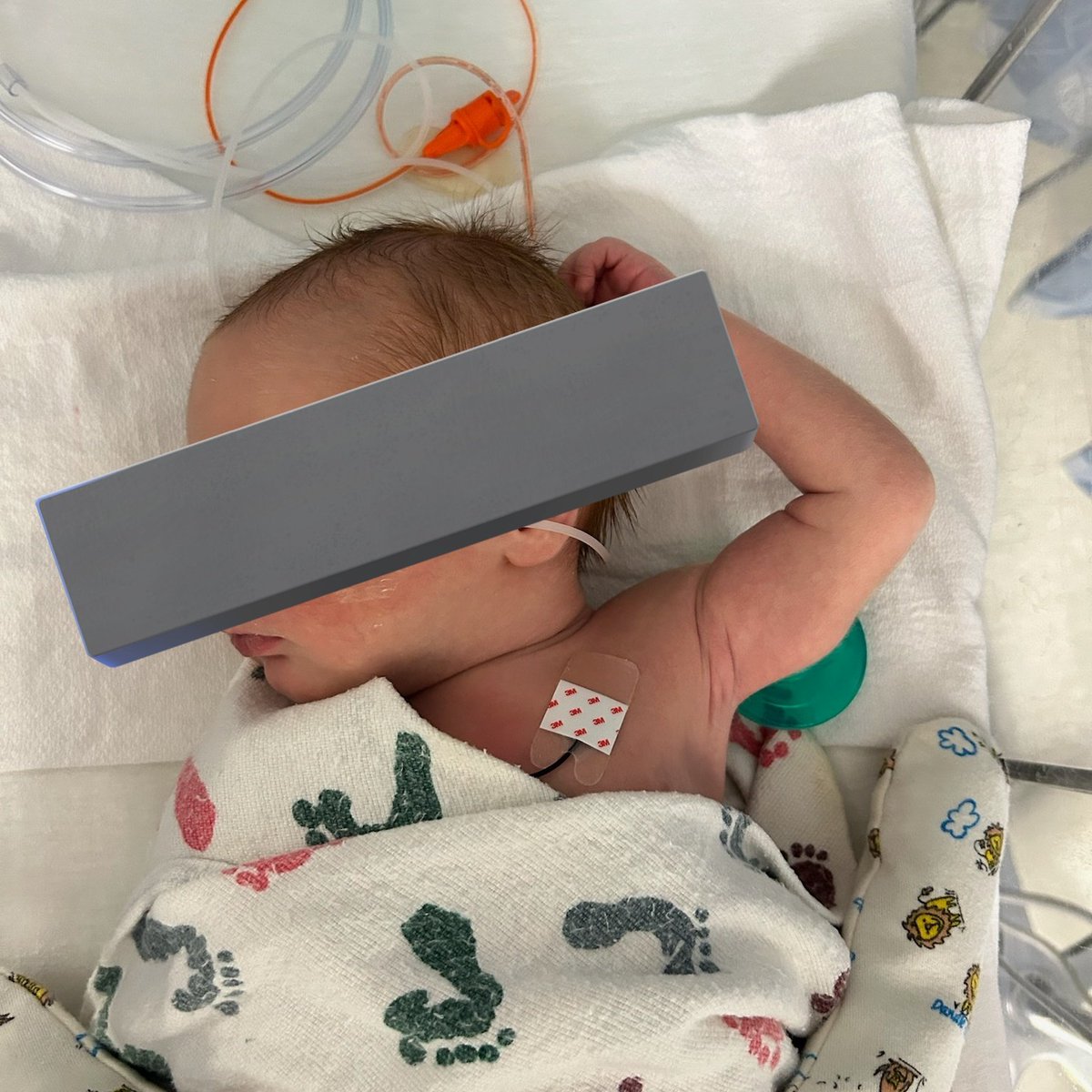 FAFOFarmsTX's tweet image. CJ Update: They're pulling his feeding tube today since he's been taking 100% of feeds from the bottle!
He's at 21% oxygen still, but only on ¼ support so they're going to try "room breathing" tomorrow.
2 days of successful bottle feeds & no help breathing baby boy can come…