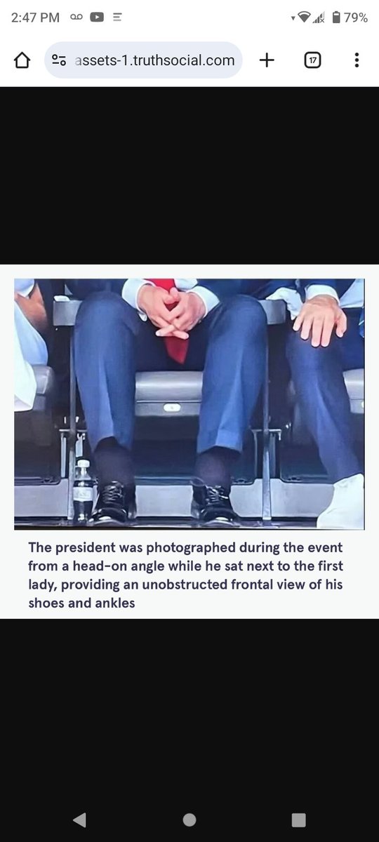 Another day, another DJT lie.

Compare pics of chronic venous insufficiency &amp; Trump's legs.  Not even close.

The doctor really said Chronic Insufficiency - Trump just misunderstood 🤣
