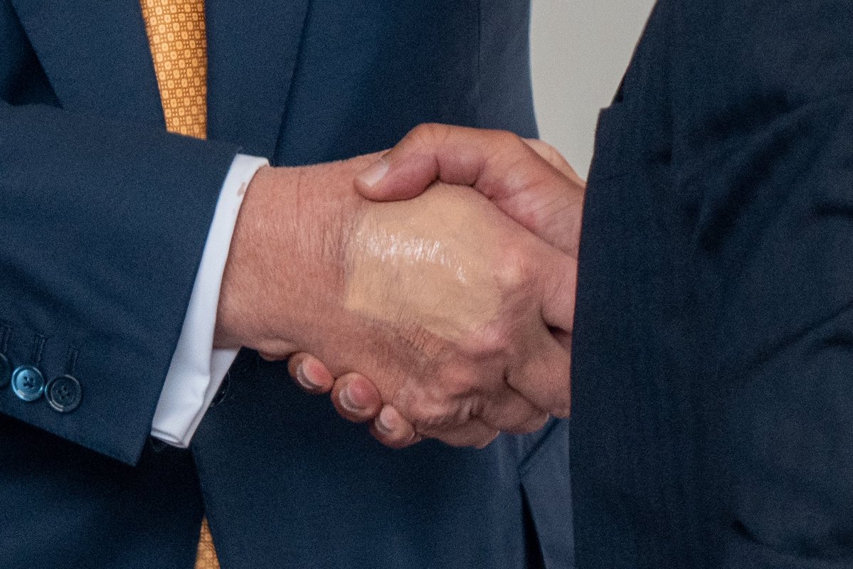 PenguinSix's tweet image. White House Press secretary, says swelling on President Trump’s hand due to excessive hand shaking and regular routine of aspirin, causing a bruise.