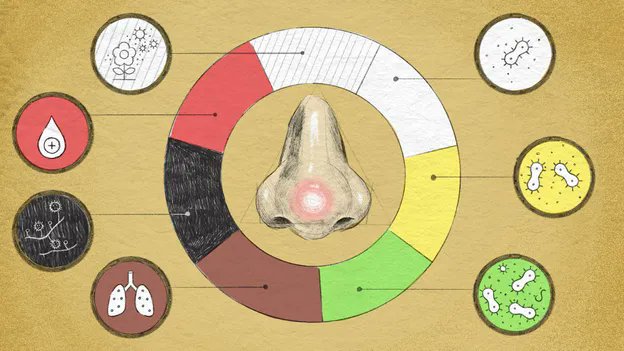World_Insights1's tweet image. What Your Snot Says About Your Health?
Snot (nasal mucus) is more than just an annoyance - it acts as your body’s first line of defense. It traps inhaled particles like dirt, pollen, and germs, while also delivering antibodies and enzymes that fight off infections. Colors and…