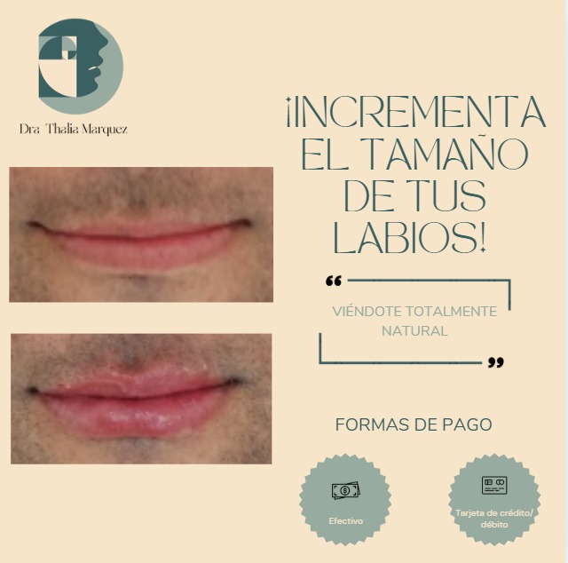 ¡Labios con más volumen, más actitud y más tú! Agenda hoy tu cita de valoración totalmente GRATUITA 🤎✨