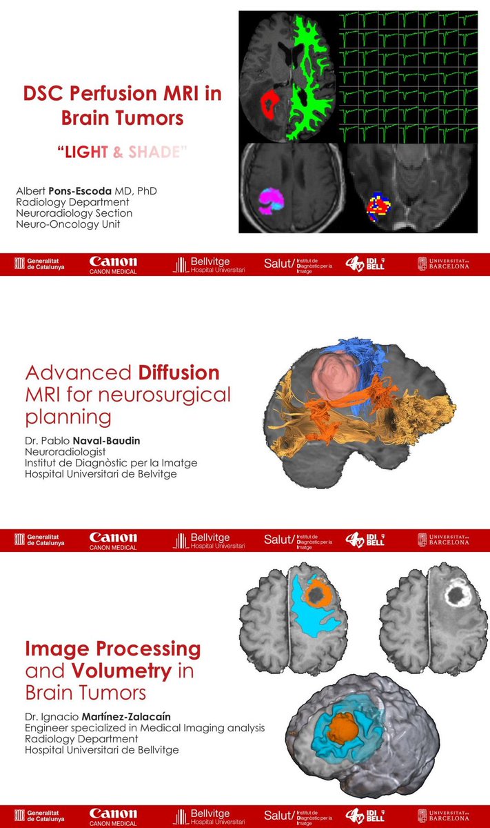 🎥 Missed our Radiomics &amp; Advanced Neuroimaging in Neuro-oncology webinar? The recording is now FREE: eu.medical.canon/events_calenda…