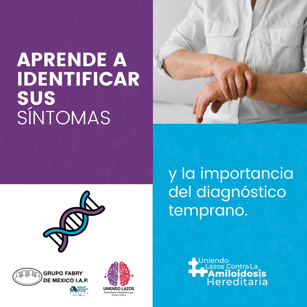 ¿Sabías que la amiloidosis hereditaria por transtiretina (ATTR) es una enfermedad genética 🧬 crónico-degenerativa que afecta principalmente a nervios🧠, corazón❤️ e hígado?
#UniendoLazos #AmiloidosisMéxico #DiagnósticoTempranohATTR