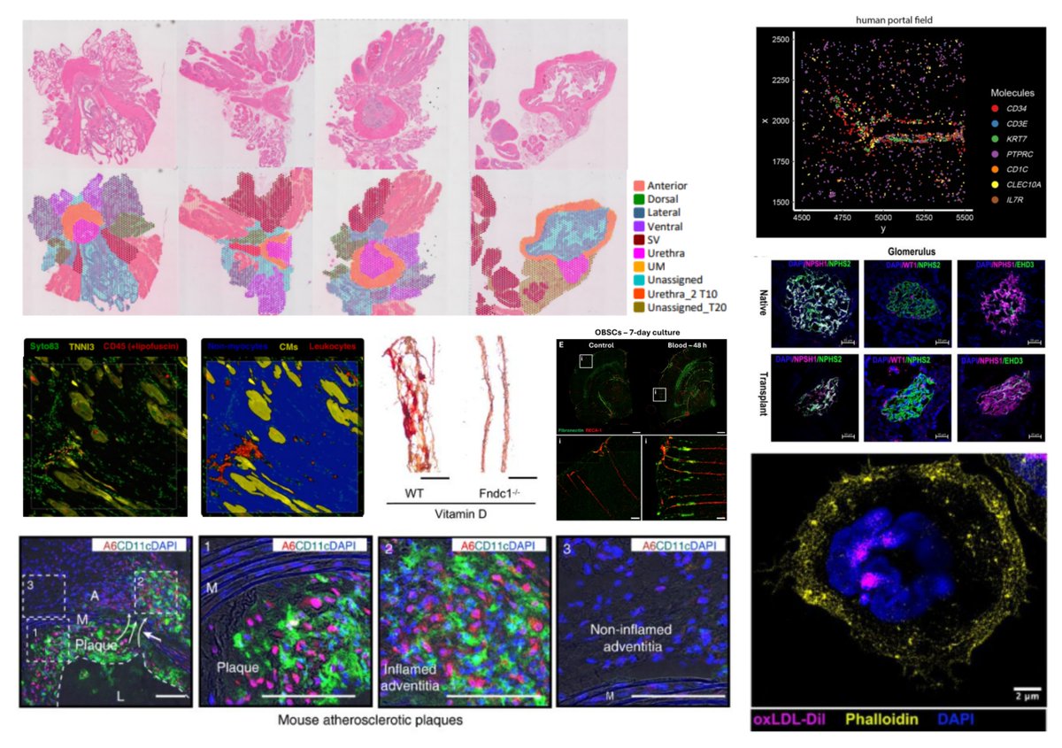HaoYin20's tweet image. Hao's Preprint Reading List
July 17th 2025
Arterial thrombosis on a chip
Autoantibody tertiary lymphoid organ atherosclerosis
Flow-dependent neuronal motility
Mitochondrial clonal tracing in human tissues
NAD+ arterial calcification
Spatial transcriptomics of myocarditis…