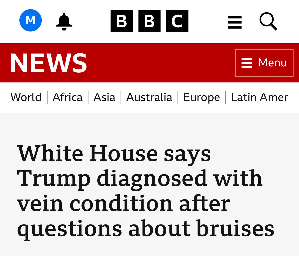 Surely it should be vain condition ⁦<a href="/BBCNews/">BBC News (UK)</a>⁩ ?