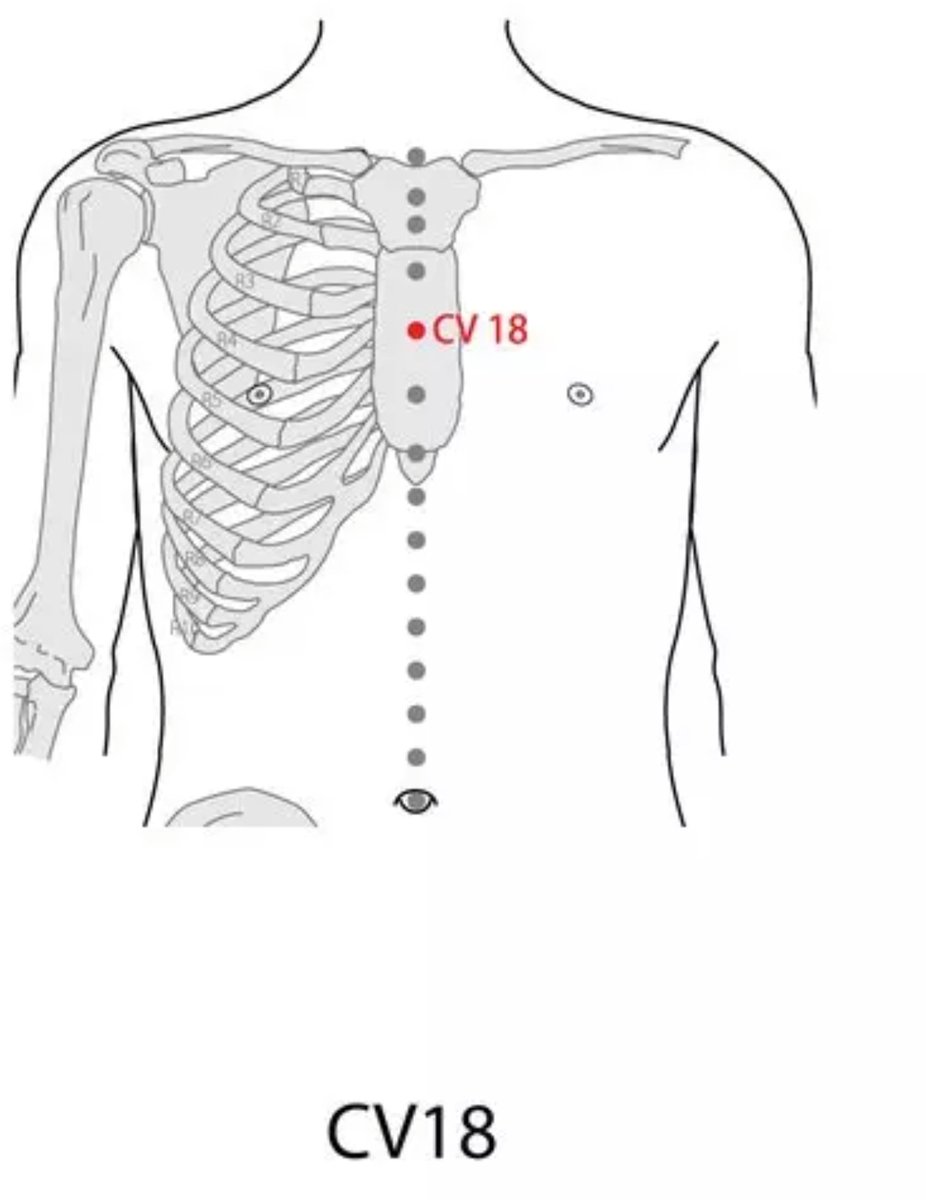 2
 ثم بنفس الطريقه عمل مساج على النقطه CV 18
كما في الصوره
ايضا لخمس دقائق.

تكرر العمليه  ٢-٣ مرات في اليوم.

بعدها دهن أعلى الظهر وكل الصدر بزيت سمسم او زيتون مرتين يوميا.

هذا يزيل الحراره يخفف او يزيل السعال والم الحلق بشكل فوري.
للكبار والصغار
من جربها يعلمنا النتائج