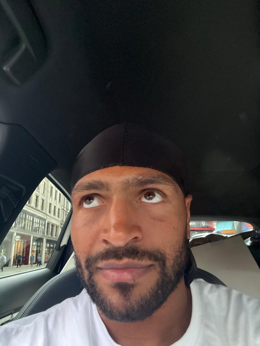 HarlemEubank's tweet image. Eye healed up nicely. Ready for the best in the world or the 2x drugs cheat. 👀