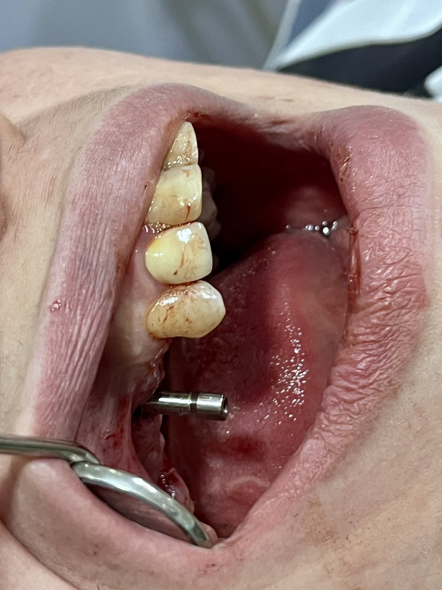 You know that you don’t know 👊🤌🏽