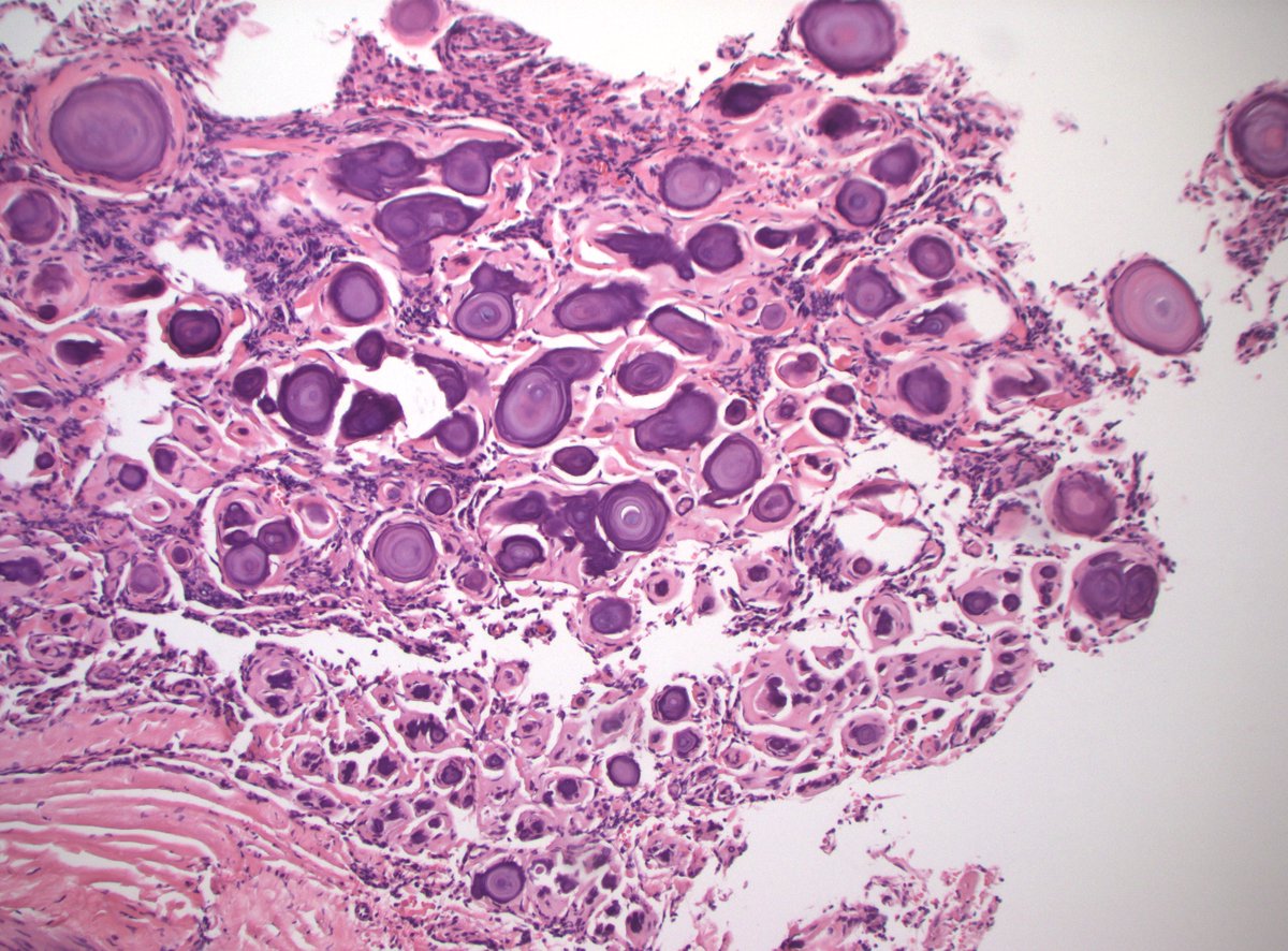 DanGrahamMD's tweet image. Organ?
Dx?

#PathX #PathTwitter