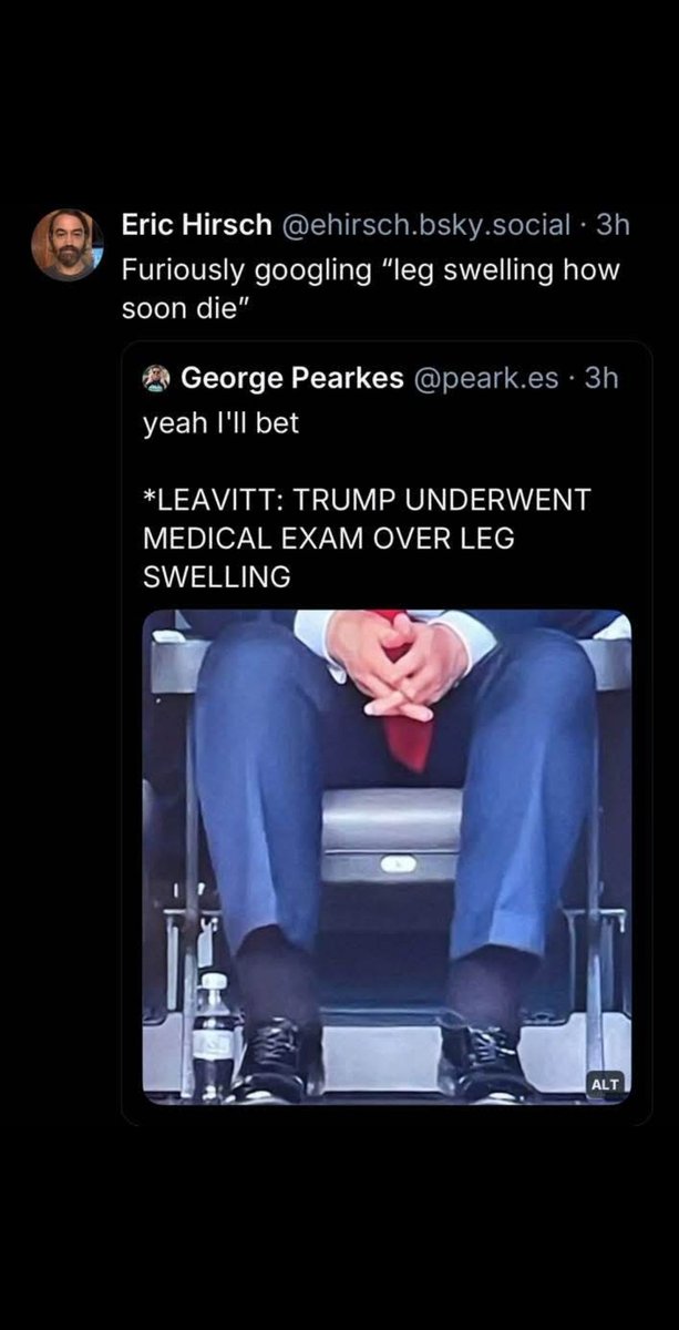 rickperlstein's tweet image. Nixon had this. Phlebitis. Developed when it looked like he might have to testify in the Watergate criminal trials.
