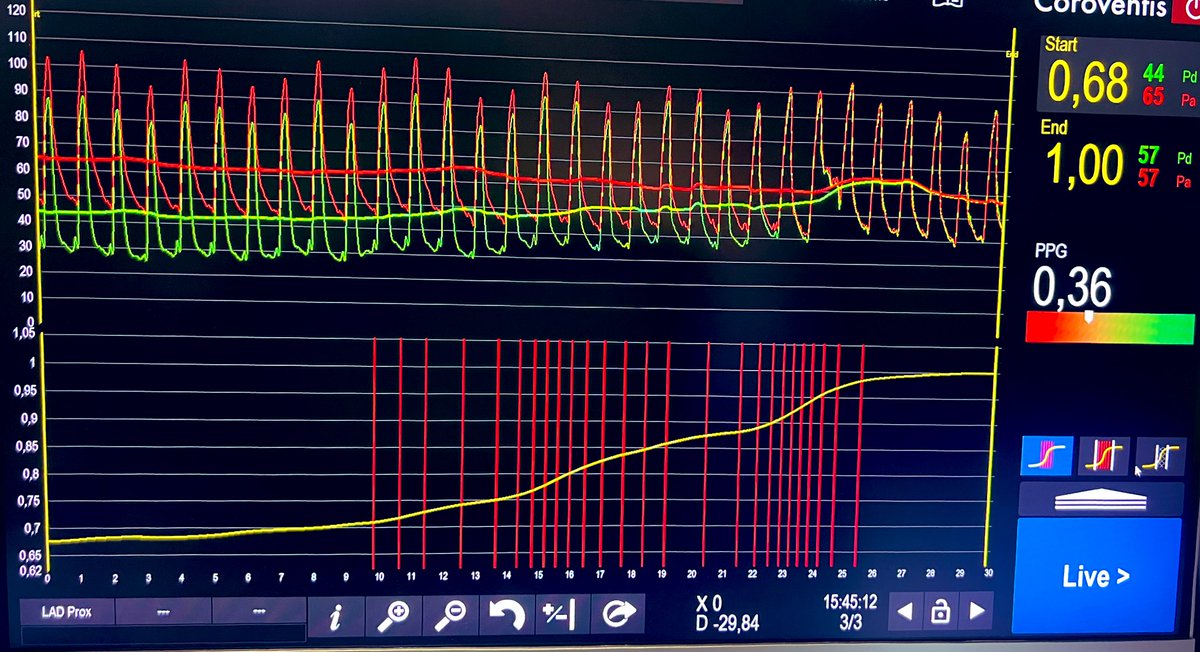 Carlos Collet MD PhD tweet media