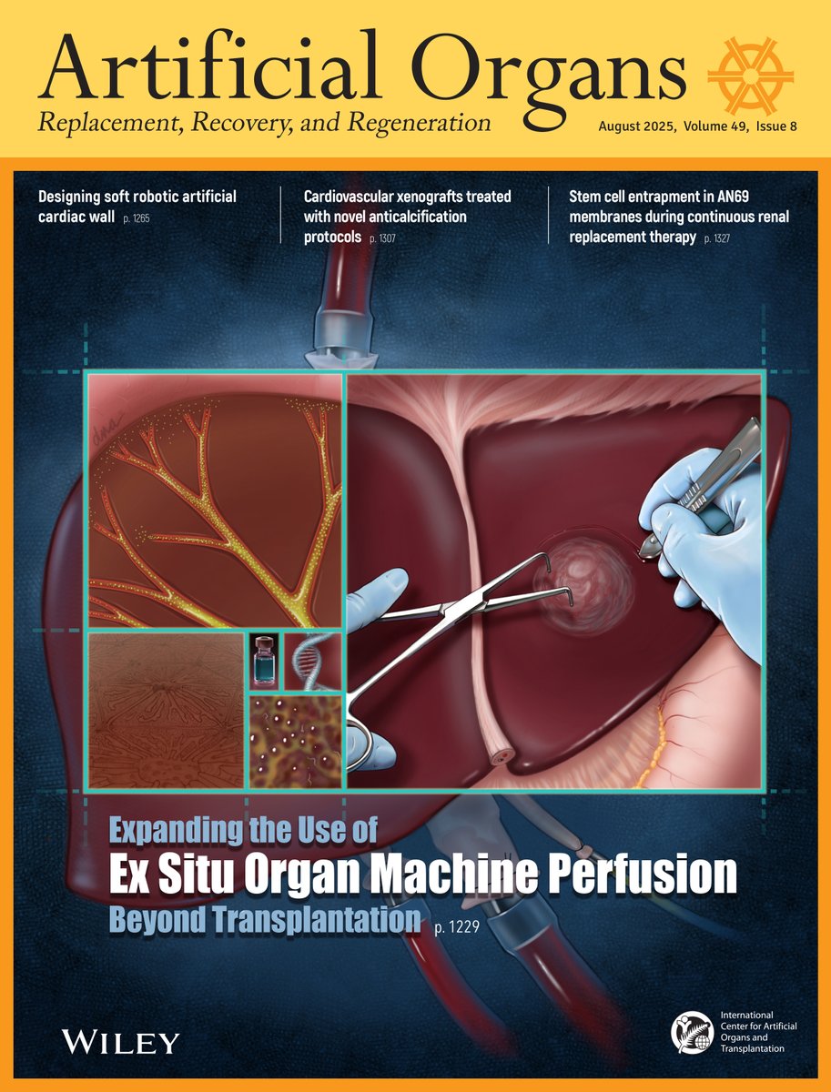 ArtifOrgans's tweet image. Check out the August issue information
👉tinyurl.com/yey8jds8
#OnTheCover: Extending the use of #ExSitu Organ #MachinePerfusion Beyond #Transplantation