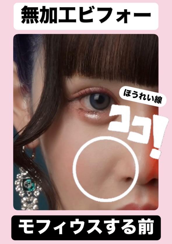 theclinic_abe's tweet photo. 第32回モフィウス プレゼント🎁
ゆりにゃさん激推しの「モフィウス」
今回も「ほうれい線」「口横のポニョ」を1名様に無料プレゼント！
お肉を取るだけでなく、皮膚の引き締めもしなきゃだめ😎
応募はこのアカウントフォローしてから、リポスト、いいねお願いします✨️
当選発表は22日です😊 https://t.co/l5yEjj7PY1