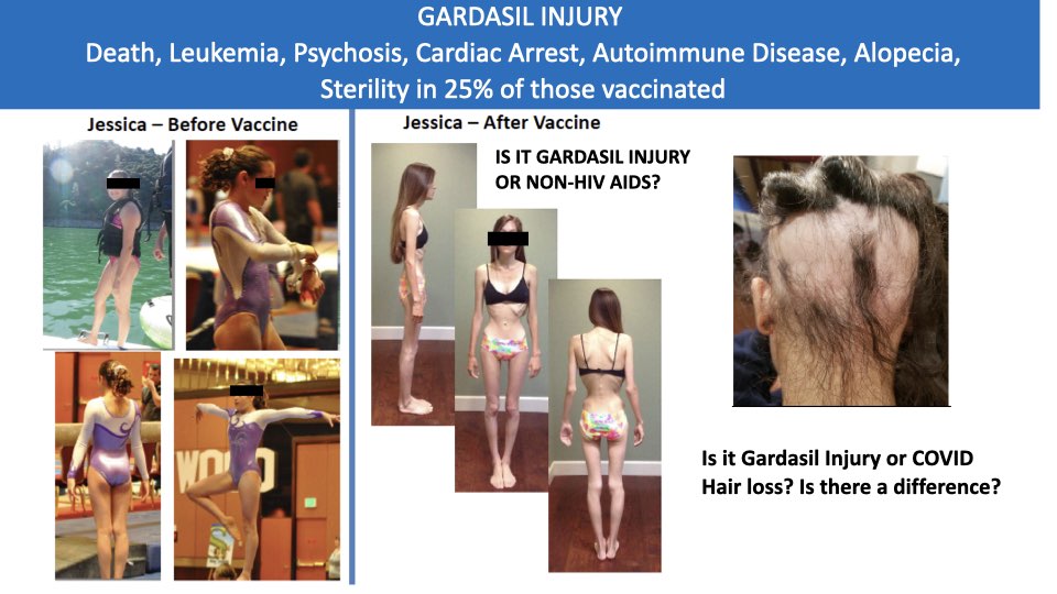In Ron Johnson's hearing yesterday, we heard a lot about Merk.
From the slides I shared at the Vaccination Panel at the NHF conference, March 16, here is the result of the Gardasil and DTaP vaccine on a 7th grader.

This was from a case we did in Vaccine Court, and of course,