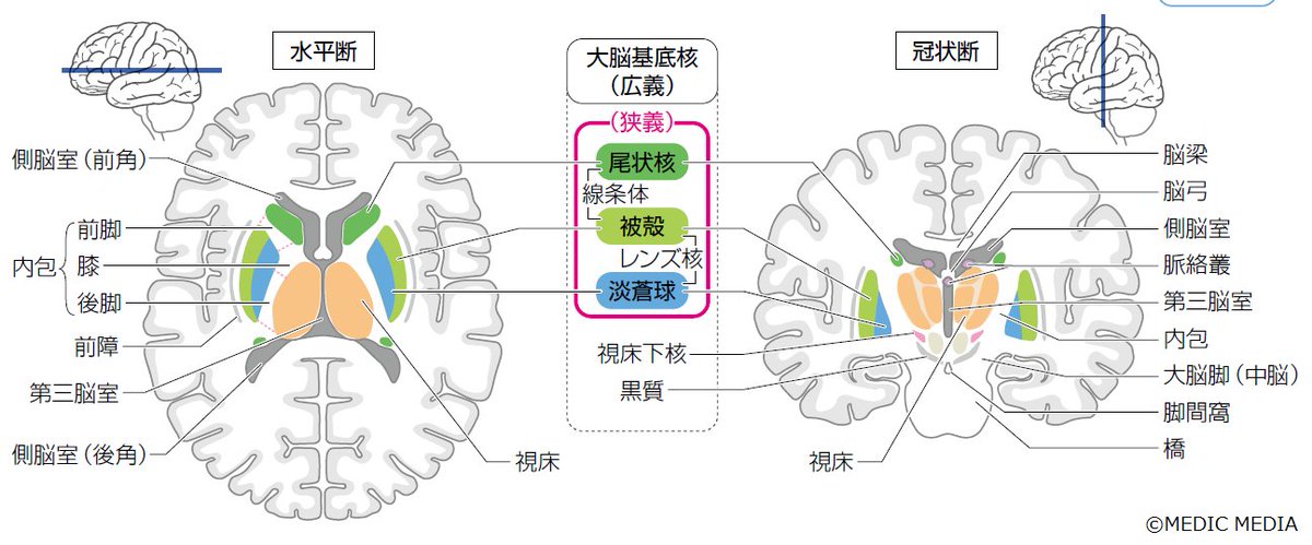 【大脳基底核】大脳基底核は左右の大脳半球の深部に存在する神経群(灰白質)で、随意運動の調節などに関与する。淡蒼球、被殻、尾状核から構成される ...