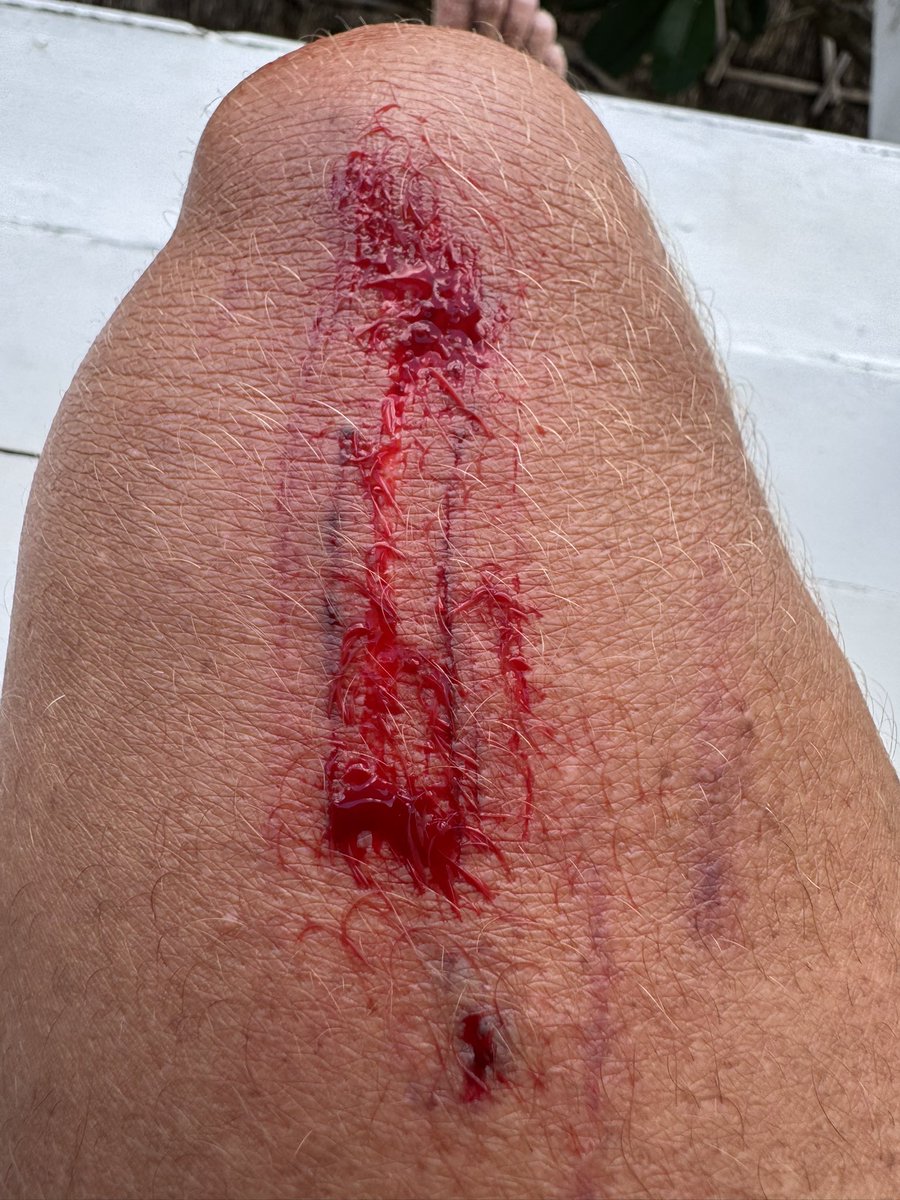 Future_Camping's tweet image. the cost of doing business 🤪🤣🥰