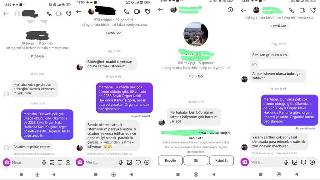 Yoksulluk organ sattırıyor

“Türk Böbrek Vakfı’na Google Maps üzerinden yapılan yorumlarda ve vakfa ait hesaplara gelen mesajlarda, çok sayıda kişinin böbreğini satmak istediği görülüyor”

<a href="/aticimerve_/">Merve Atıcı</a> ,nin haberi