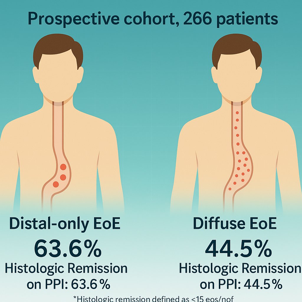 Yuri Gorelik (@gorelikyuri) on Twitter photo In isolated distal esophageal #EoE is more like GERD as can be assumed from this <a href="/AGA_CGH/">CGH</a> study.
Patients with isolated distal esophageal eosinohils were much more likely to respond to PPIs
👇 In isolated distal esophageal #EoE is more like GERD as can be assumed from this <a href="/AGA_CGH/">CGH</a> study.
Patients with isolated distal esophageal eosinohils were much more likely to respond to PPIs
👇