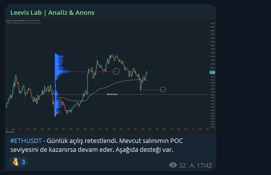 Le²vis 💱 tweet media