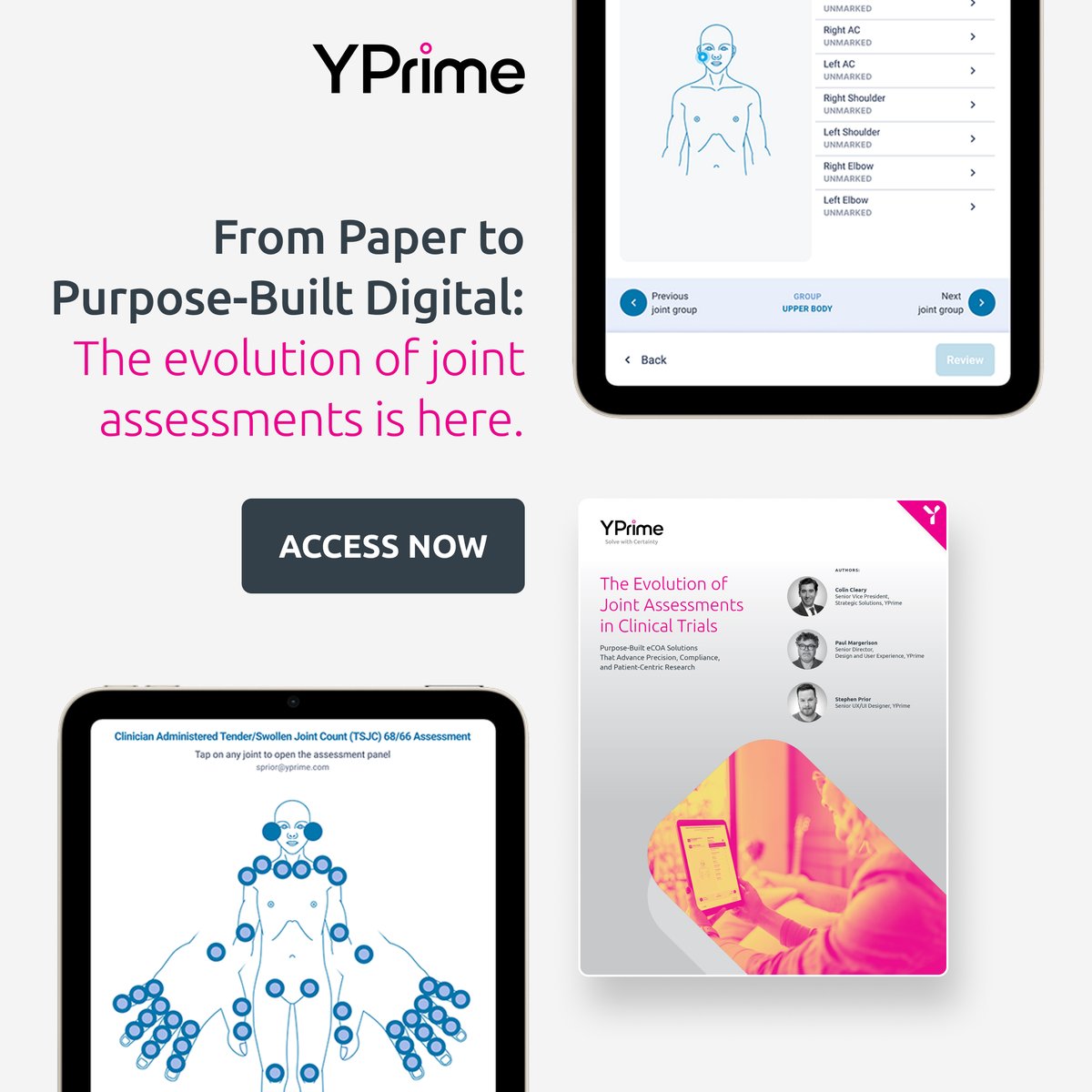 Joint assessments are essential in inflammatory arthritis trials, but paper-based methods slow teams down and increase error risk. YPrime’s eCOA streamlines assessments, improves consistency, and reduces site burden. Learn about our TSJC assessment here: hubs.ly/Q03xJH6j0