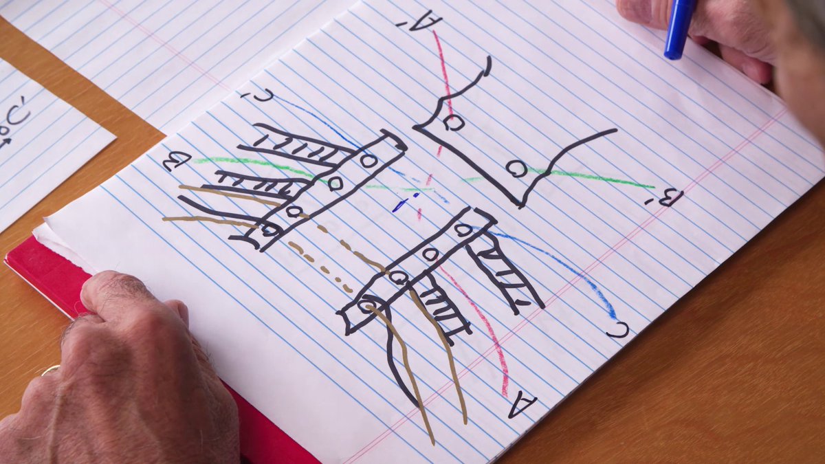 How to Close an Upper Ministernotomy  

In this exceptional video by Dr. Vince Gaudiani, he demonstrates how to close an upper ministernotomy. 

🔗ow.ly/c0Zf50WqJfT

#cardiac #sternotomy