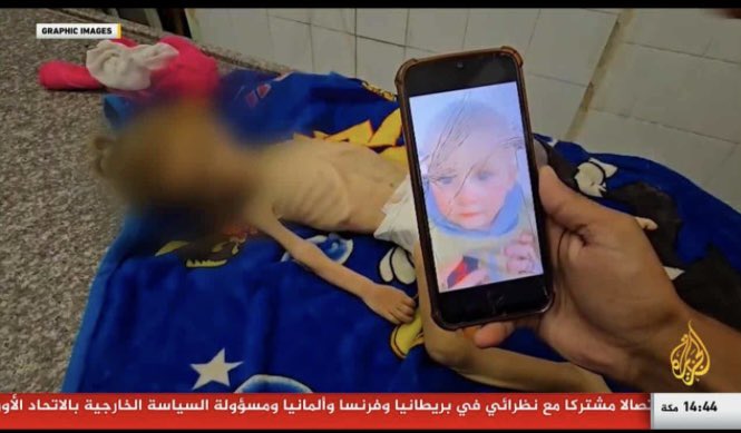 zenatahhan's tweet image. The latest baby to die of Israel’s forced starvation in #Gaza.
One-and-a-half‑year‑old Sanaa al-Lahham.
At least 69 Palestinian children have starved to death in Gaza.