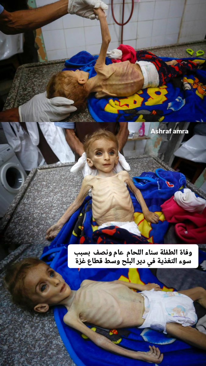Ahmed_A1Najjar's tweet photo. Look at her wide eyes.
This is Sana Al-Laham, just one and a half years old. The world and Israel have just killed her by starvation. Just a few more days, and thousands more of us will be killed the same way. https://t.co/obJfN8yZyQ