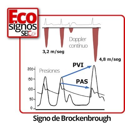 Signo de Brockenbrough
📌 buff.ly/3tnisaF ◀️
Somos muy de Ecosignos
Imágenes creadas por García Fernández
Para Socios de la SEIC ⤵️
👤 buff.ly/cqNJytl ◀️