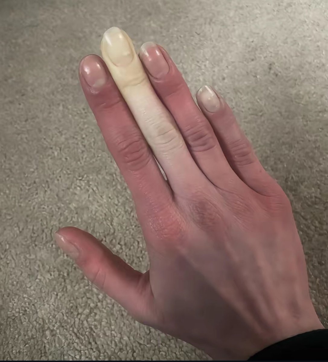 skiistiredasf's tweet photo. What's the cause of this?? https://t.co/URQzUmeReO