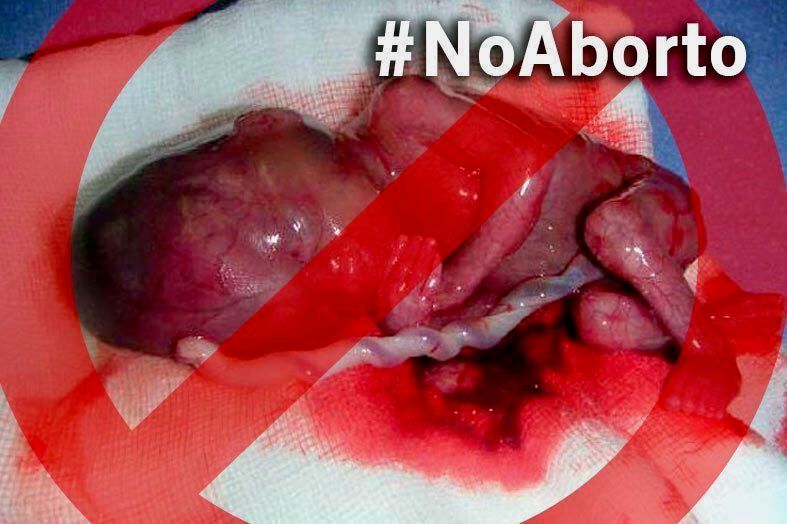 73 millones de niños asesinados en el vientre de sus madres, el pasado año, unos 200.000 por día. ¿De qué derechos estamos hablando?