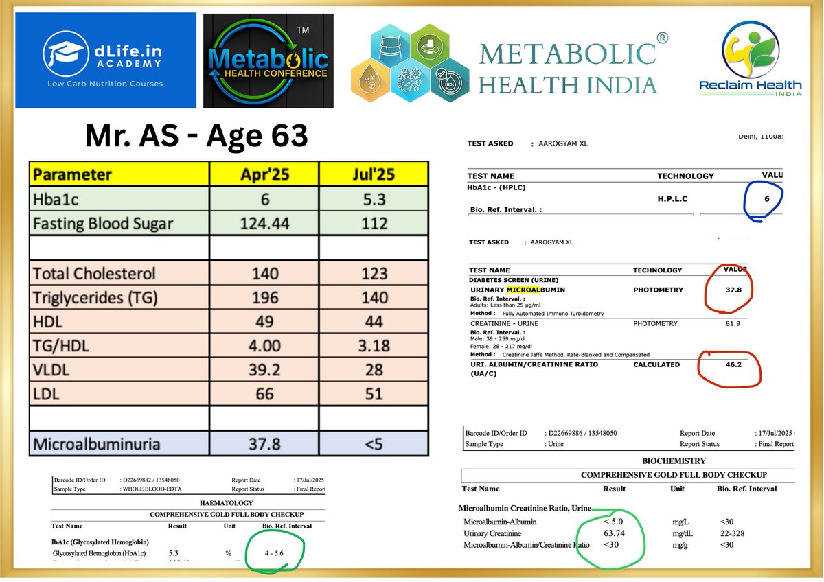 Mr. A.S. – Age 63 – work in progress

Type 2 diabetes, Early Parkinson’s, Microalbuminuria, Metabolic Disruptions.

But also Determination to Heal.

In just 3 months on a low-carb plan (100g max – Anup <a href="/dlifein/">Anup Singh - Founder CEO dLife Healthcare Pvt Ltd</a>):

✅ HbA1c from 6 to 5.3
 ✅ Microalbuminuria from 37.8 to <5
 ✅
