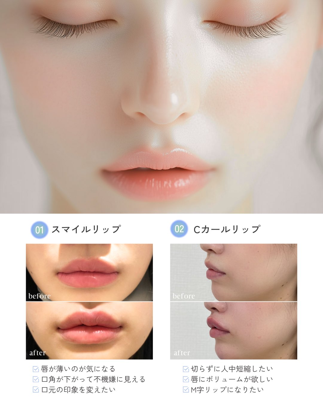 実践フィラー注入テクニック Amazon.co.jp: 実践フィラー注入テクニック : 岩城佳津美: 本