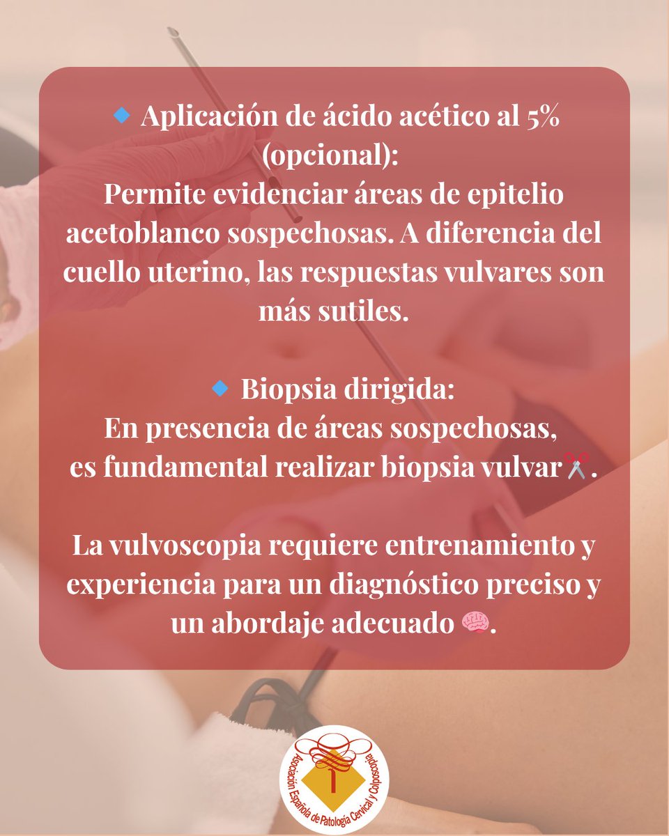 ¿Cómo se realiza una vulvoscopia?🧐

Una herramienta diagnóstica esencial en la práctica ginecológica.

Te lo contamos en el post👀

#Vulvoscopia #Ginecología #DermatologíaVulvar #BiopsiaVulvar #SaludFemenina