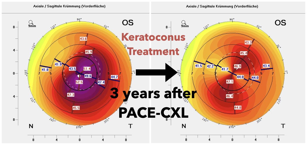 Emilio Torres-Netto tweet media